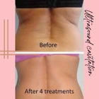 Skulpted Skin the Body Contouring Specialist