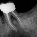 Dr. Bas Michael Antic Groen, DDS - Endodontists