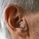 Advanced Audiology Service - Audiologists