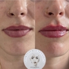 Flawless Rejuvination Aesthetics gallery