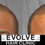 Evolve Hair Clinic