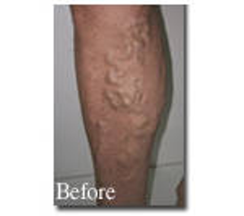 Vein Health Medical Clinic - Melbourne, VIC