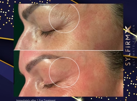 Clean Laser Clinics - Teneriffe, QLD