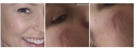 Peter Randle - Cosmetic Surgery