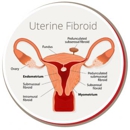 USA Fibroid Centers - Clinics
