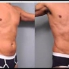 Elite Body Sculpting gallery