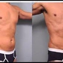 Elite Body Sculpting - Physicians & Surgeons, Plastic & Reconstructive