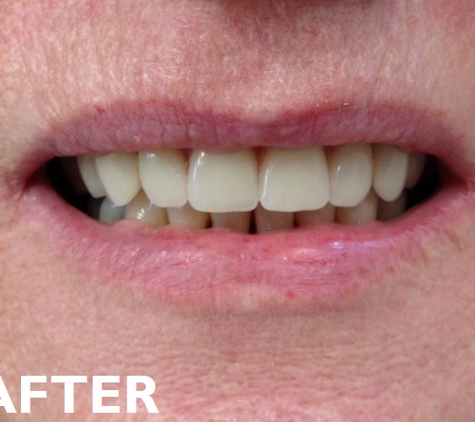 Warrawong Denture Clinic - Warrawong, NSW