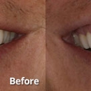 Harris Dental - Teeth Whitening Products & Services