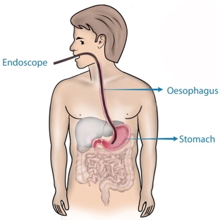 Central Coast Gastroenterology - Dr Parkin David - Hamlyn Terrace, NSW