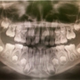 Boise Oral and Maxillofacial Surgery