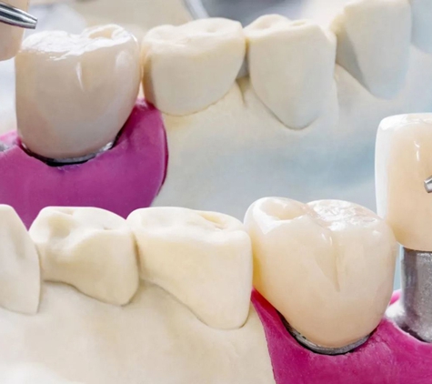 Bellerive Denture Clinic - Bellerive, TAS