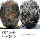 Marotta Hair Restoration - Physicians & Surgeons, Plastic & Reconstructive