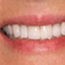 Dr. James A Vette DDS - Teeth Whitening Products & Services