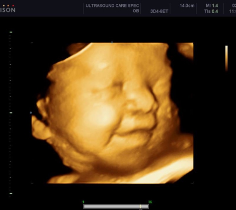 Ultrasound Care Specialist - Orlando, FL