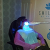 SmileLabs of Pleasanton Cosmetic Teeth Whitening gallery