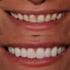 Dental Implant Solutions of Idaho gallery