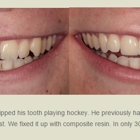 Facer Hales Parker Dentistry | Veneers - Implants - Comprehensive
