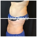 UniQ Laser Center Watertown - Day Spas
