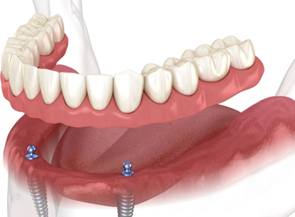 Geelong Denture Care Centre - Geelong, VIC