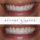 Colonial Heights Dental Group - Implant Dentistry