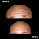 Mister Botox - Medical Spas