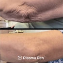 Limelight Laser and Medical Spa - Hair Weaving