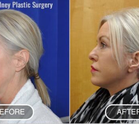 Sydney Plastic Surgery® - Dr Barnouti - Glebe, NSW