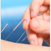 Diane F Mess Accupuncture & Herbs gallery