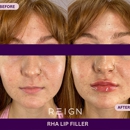 Reign Medical Aesthetics and Wellness - Day Spas