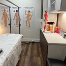Hu, Qingmei - Acupuncture