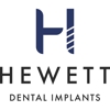Hewett Dental Implants gallery