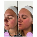 The Med Spa of Kingwood - Day Spas