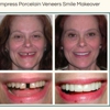 Center for Cosmetic Dentistry : Dr. Paul Sussman gallery
