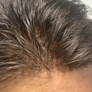 Invisahair - Hair Replacement