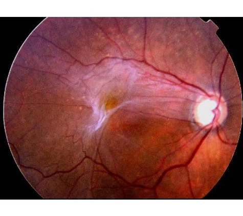 Sydney Retina - Sydney, NSW