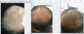 Millennium Clinic - Hair Treatment & Replacement