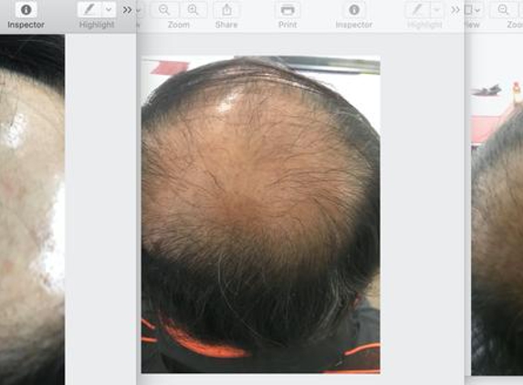 Millennium Clinic - Sydney, NSW. 1. Week 2.   2. Week 6.   3.Week 16. 3 months to go...