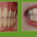 Steven J Baldwin, DDS - Implant Dentistry