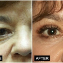 Spirit Lift Plastic Surgery - Physicians & Surgeons, Plastic & Reconstructive