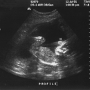 An Angel's Choice Adoption Agency, Inc. - Adoption Services