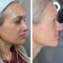 Unfiltered Beauty WNY - Skin Care