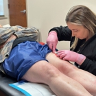 St. Louis Laser Vein Center