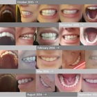 Leiker Orthodontics - Woodlands