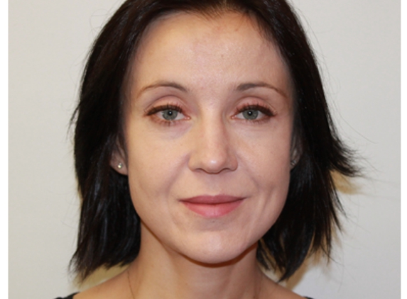 Dr. Agnieszka Kokoszka, MD - New York, NY