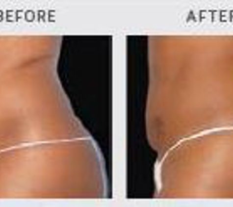 California Vein Specialists - Newport Beach, CA