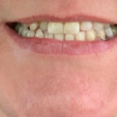 Affordable Dentures - Prosthodontists & Denture Centers
