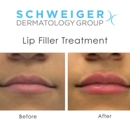 Schweiger Dermatology Group - Physicians & Surgeons, Dermatology