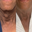 TS Browshes Esthetics and Laser - Day Spas