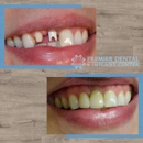 Premier Dental & Implant Center - Dentists
